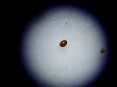 A varroa mite